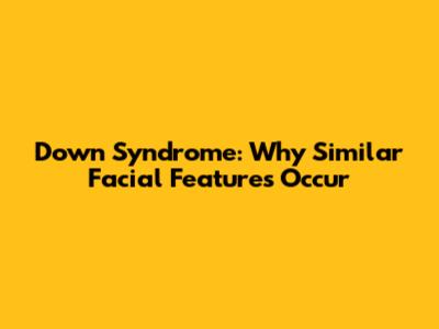 Down Syndrome: Why Similar Facial Features Occur
